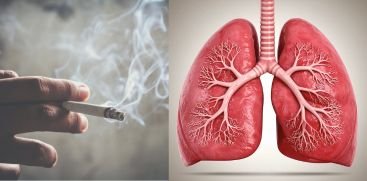 Beyond Smoking: 5 Everyday Habits That Are Silently Damaging Your Lungs